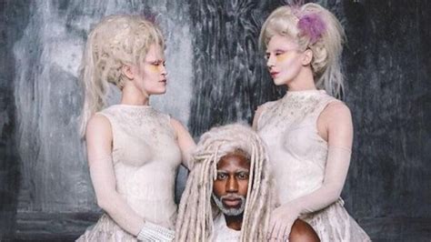 caoife coleman and mishay petronelli|The costume twins albino (Caoife Coleman and .